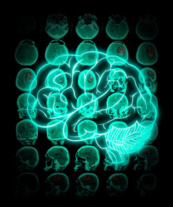 Uman Brain Against The Background Of Ct Scan