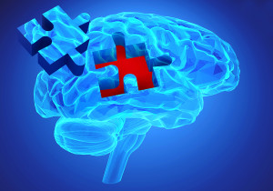 Dementia Disease And A Loss Of Brain Function And Memories
