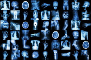 X-ray Multiple Part Of Adult And Child And Disease
