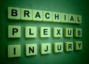 Brachial Plexus Injuries and Birth Injury